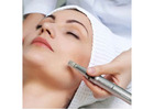 Facial Acupuncture NYC